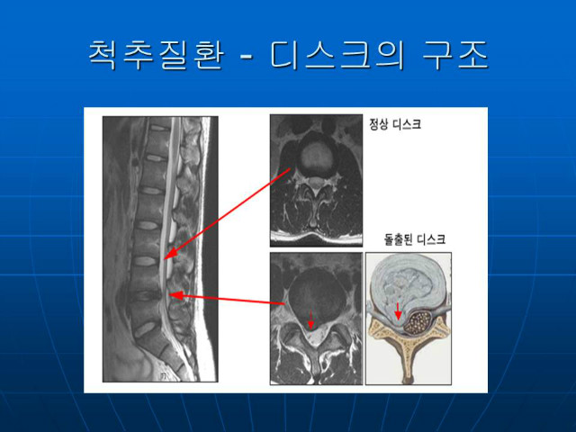 슬라이드44.JPG