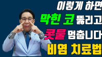 알레르기 비염