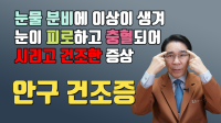 안구건조증