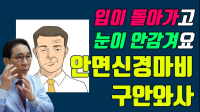 구안와사/안면…